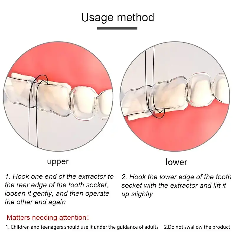 Angzhili 5 Pack Clear Aligner Removal Tool Remover for Invisible Brace Tooth Cleaning — pack of 5
