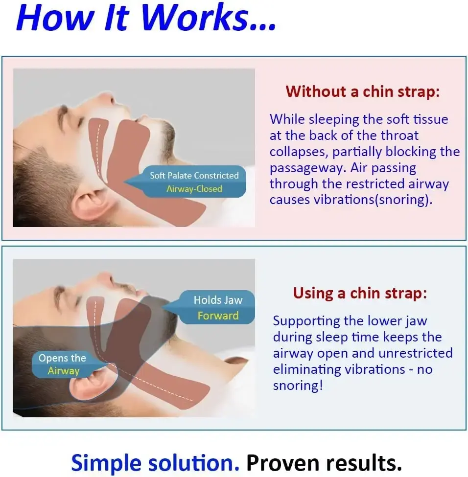 Anti Snore Chin Strap — Sleep Wellness