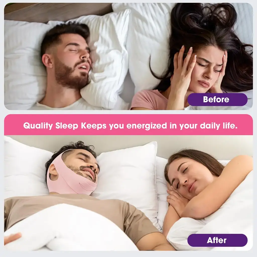 Anti Snore Chin Strap Upgraded EasYoung Snoring Solution Effective Anti Snore Strap — Sleep Wellness