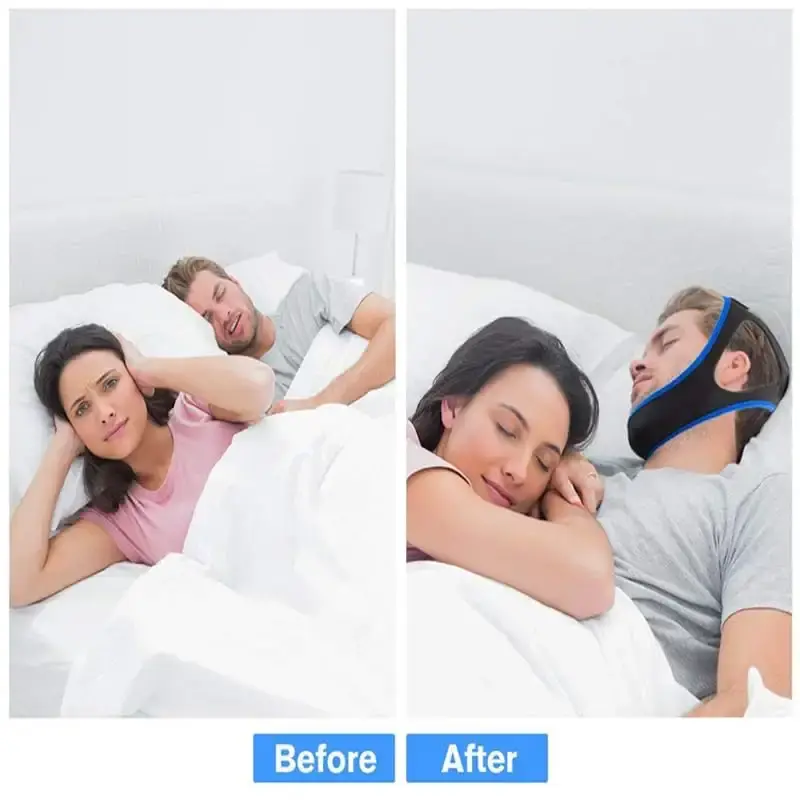 Anti Snoring Chin Strap Devices Solution Sleep Apnea Devices Stop Snoring Mouth Guard — Sleep Wellness