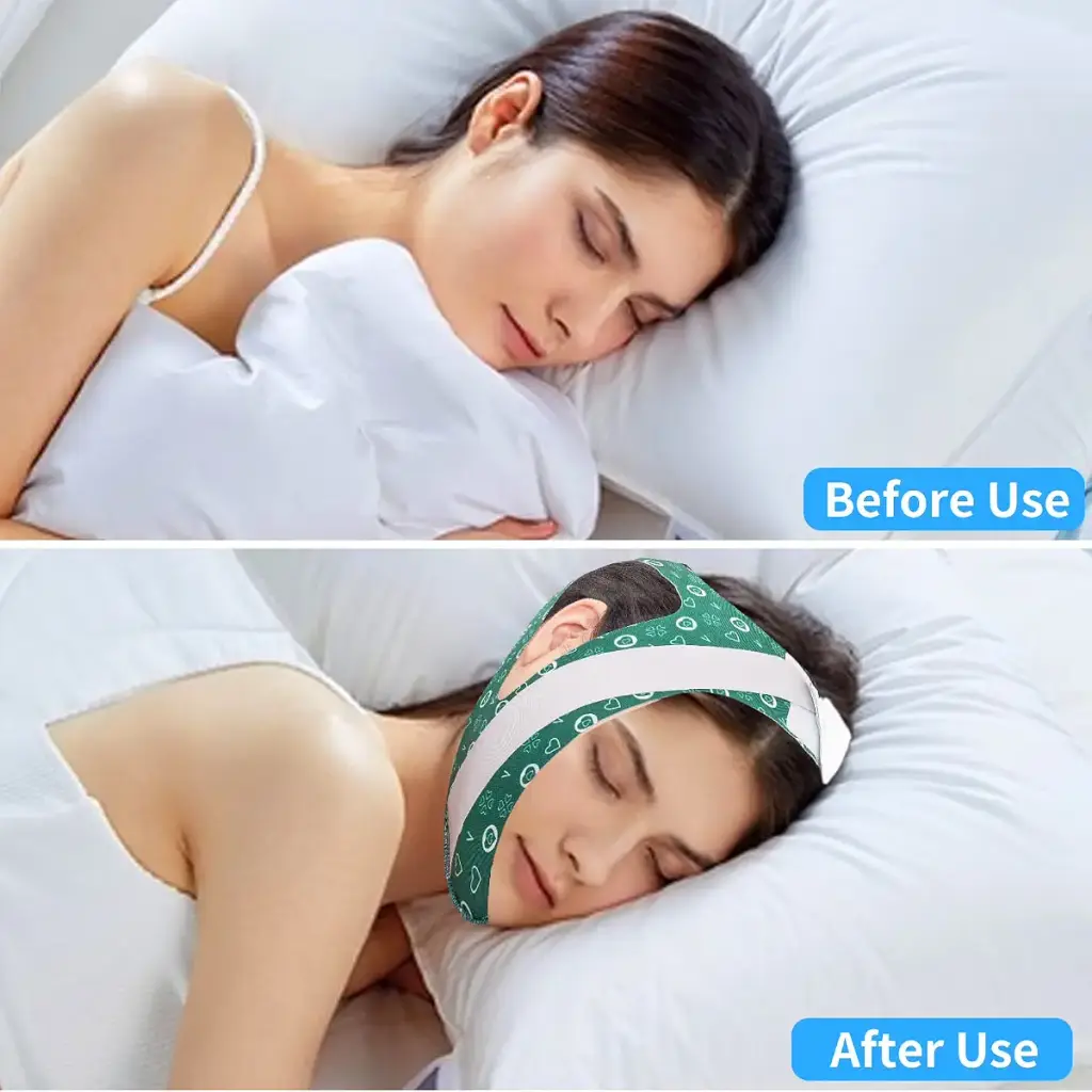 Anti Snoring Chin Strap Newest Chin Strap for Snoring Breathable and Adjustable Snoring — Sleep Wellness