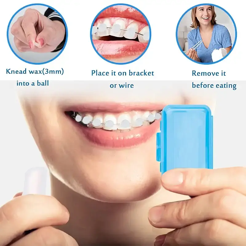 Braces Wax for Teeth 6 Pack Dental Care Orthodontic Wax for Braces Wearer (6 Pack — pack of 6