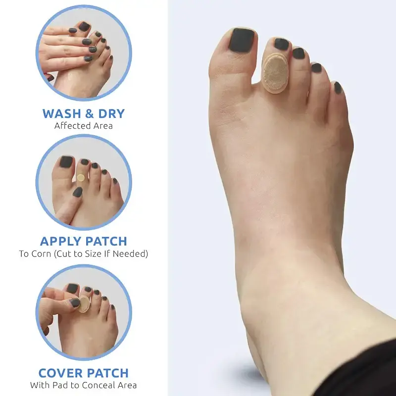 Comfort Zone Corn Removers Medicated Patches, Effective Corn Removal Pads with Salicylic — Body Support