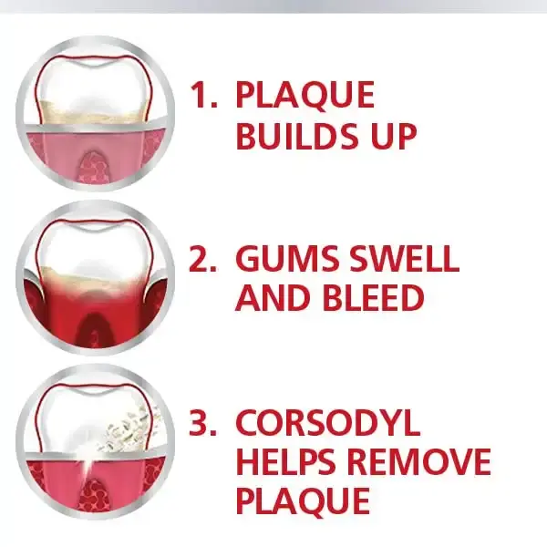 Corsodyl 0.2% Gum Disease & Bleeding Treatment Mouthwash Alcohol Free Mint Flavour 300 ml — Mint