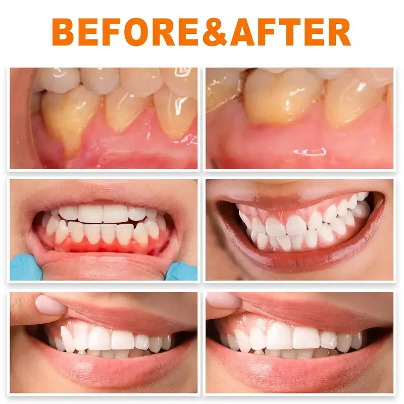 Lenaro oral repair treatment ampoules ampoules for oral repair treatment lenaro gum — Oral Care
