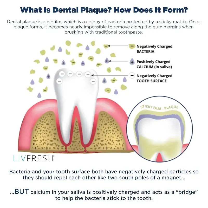 LIVFRESH Dental Gel by Livionex (Formerly Livionex Dental Gel) - Clinically Proven to — Oral Care