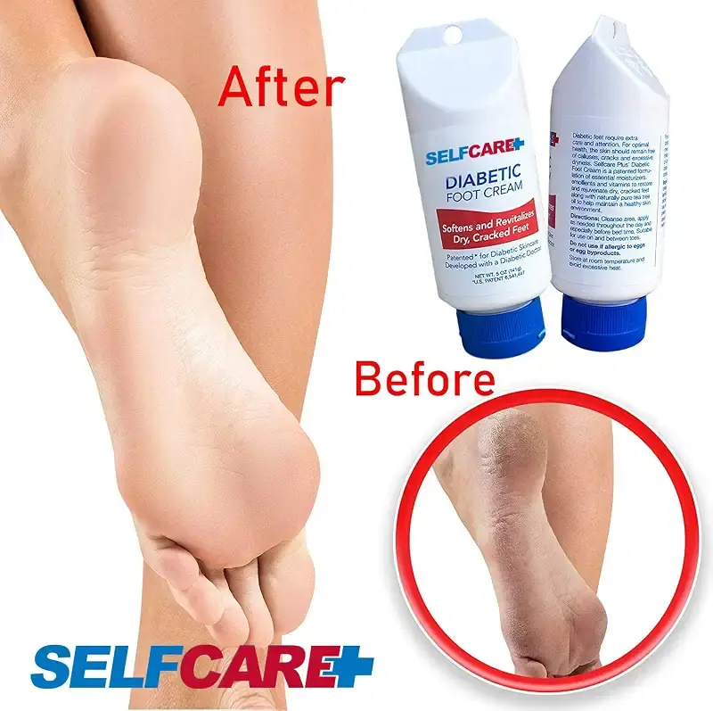 Selfcare Plus Diabetic Foot Cream For Dry Cracked Feet. Leaves Hands Legs Feet & Body — 5 oz